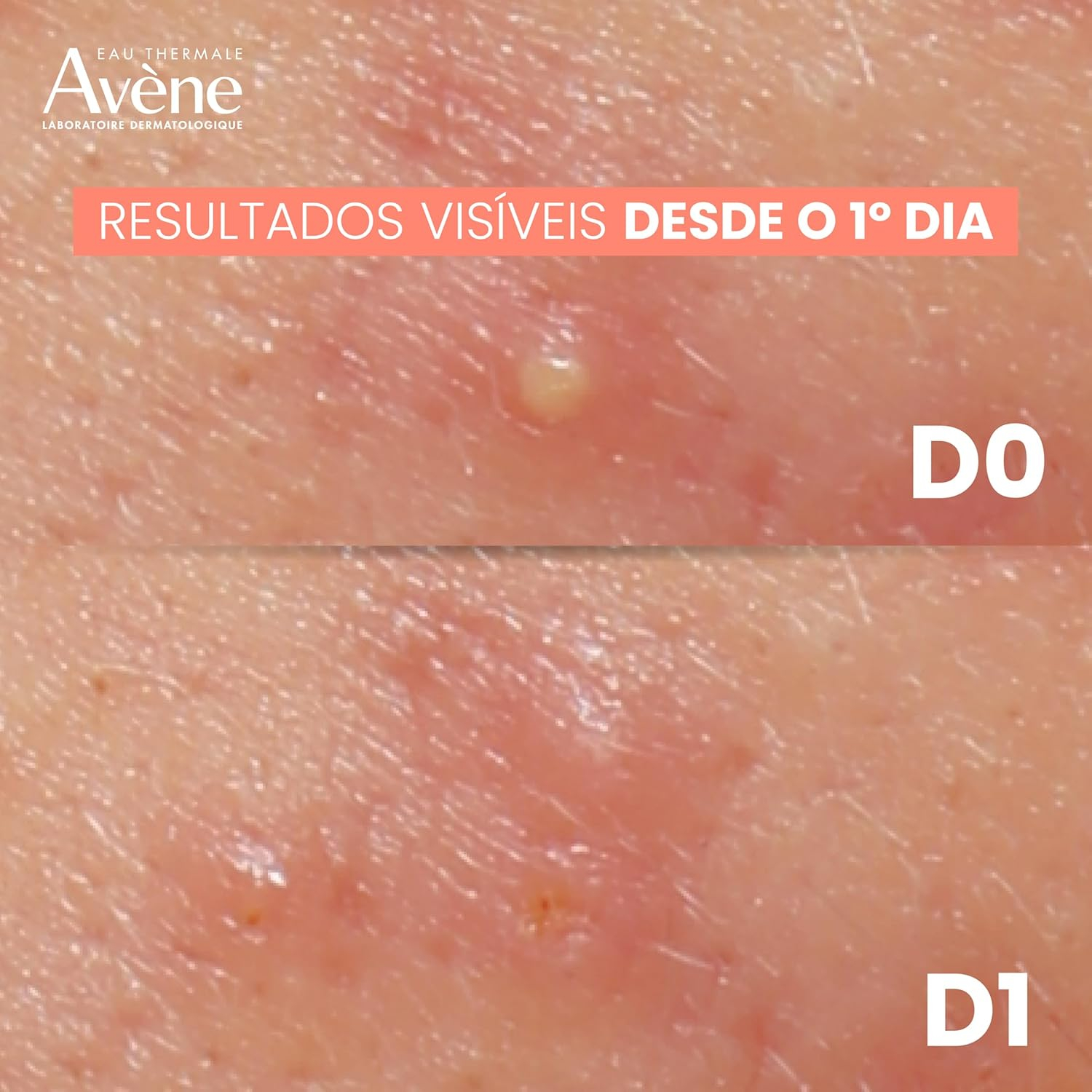 Avene Cleanance Comedomed Peeling Crema 40 ml. - Imagen 5